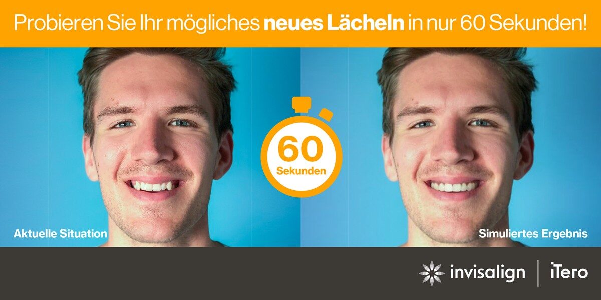 Invisalign SmileView Vorschau